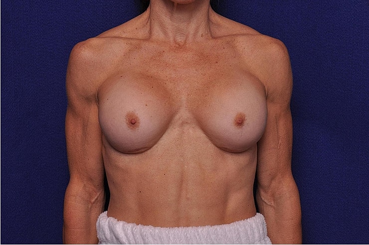 Female torso against blue background.