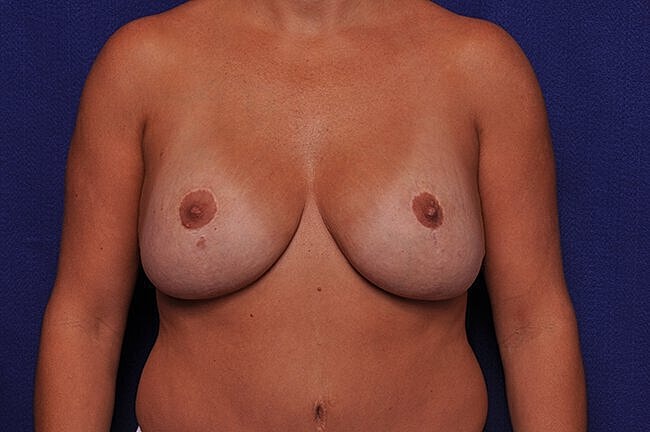 Nude torso with natural skin tone and texture.