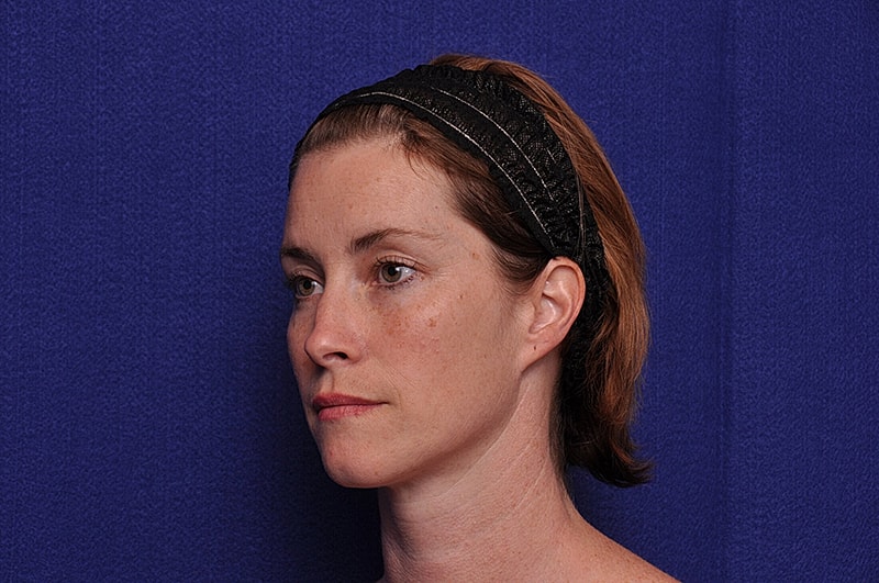 Profile of a woman with a headband.