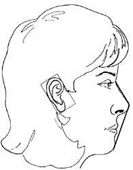 Profile illustration of female head and ear.