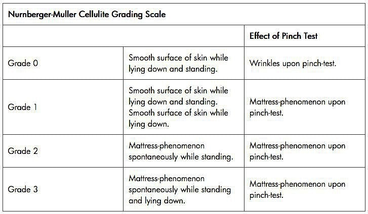 Nurnberger-Muller cellulite grading scale overview.