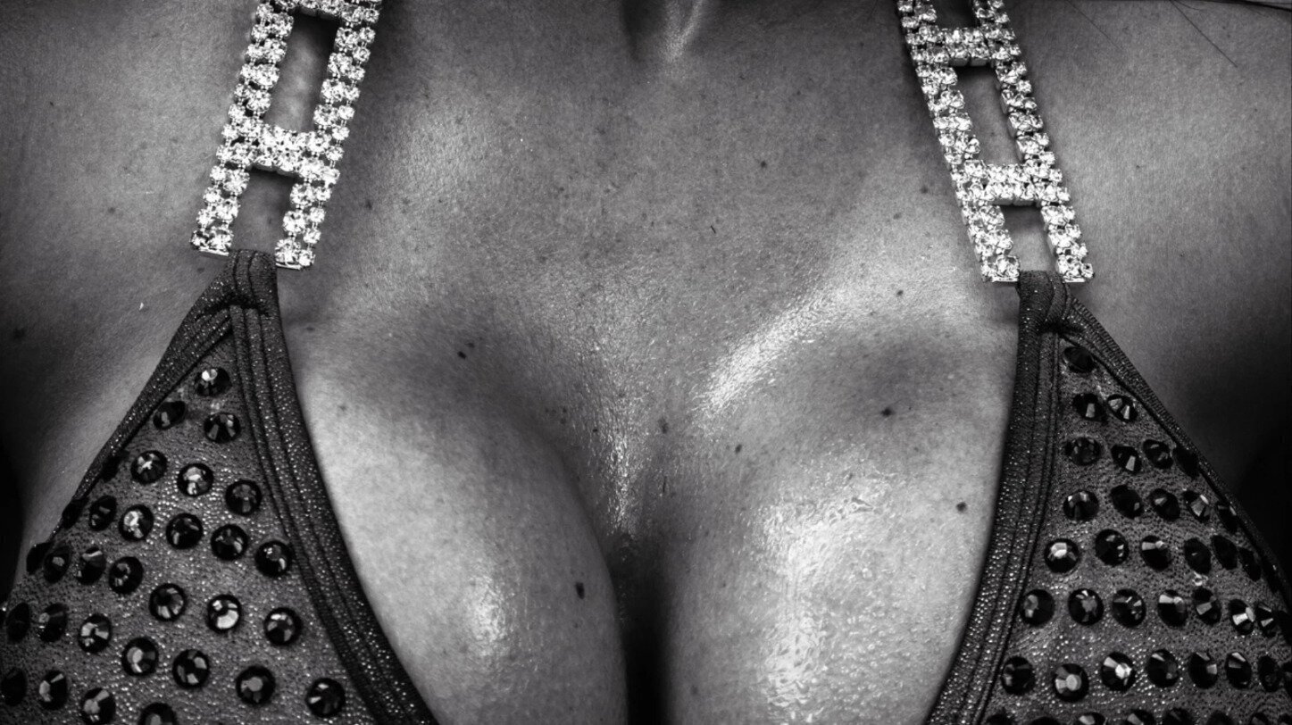 Breast Augmentation for Female Bodybuilders
